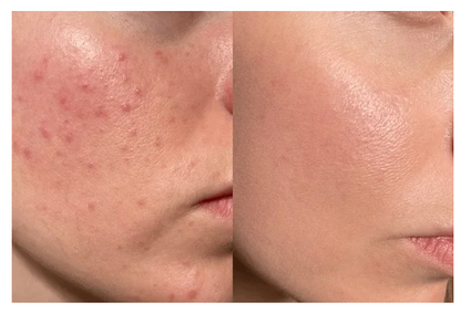 DR. MELAXIN- CREMA TX+ENVIO GRATIS